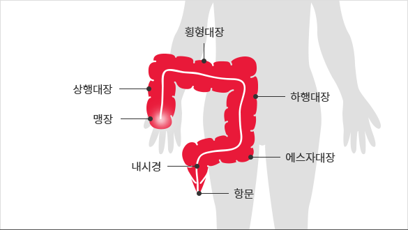 대장 내시경